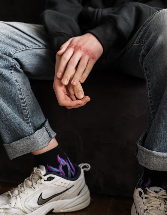Man with injured fist